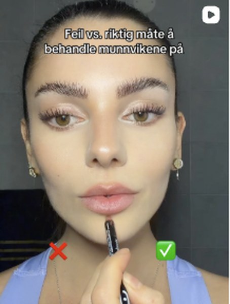 Feil vs. riktig måte å behandle munnvikene
