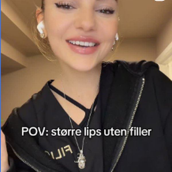 POV: større lips uten filler